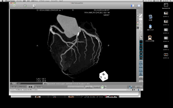 a0055913_07176.gif