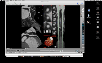 a0055913_072775.gif