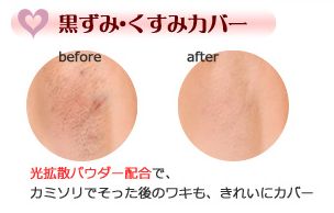 脇の黒ずみくすみ解消 エチケットプルーフ 口コミ 脇の黒ずみくすみ解消 エチケットプルーフ 口コミ