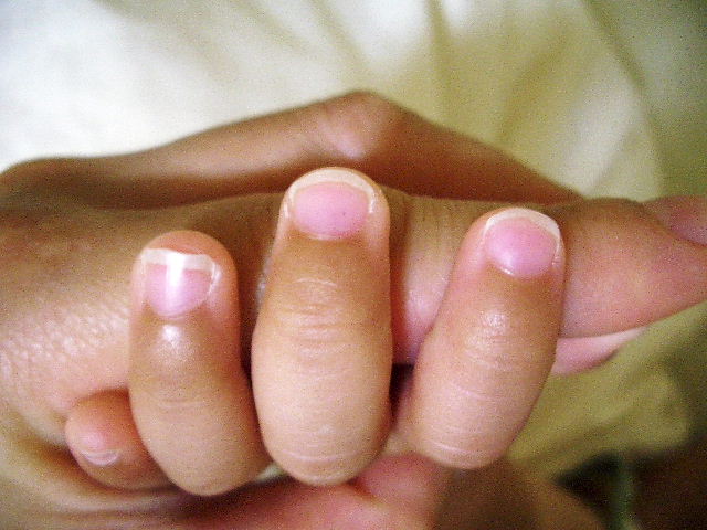 子どもの爪の伸びる早さを調べる 10日間の経過観察 毎日を楽しく暮らす