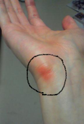 職業病 細やかな音色を啓してみよう