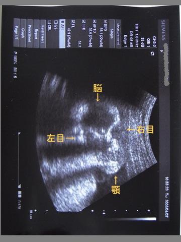 e0142283_2023231.jpg