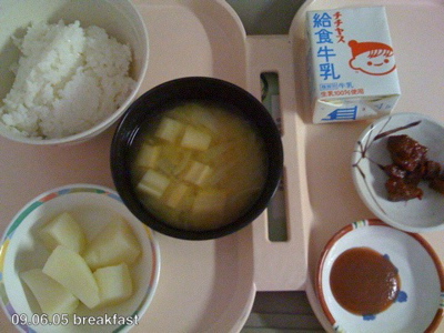 ●入院8日目 退院ヽ(´▽`)/_a0033733_17455355.jpg