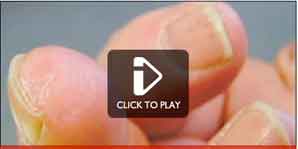 \"The man who grew a finger” / 再生する指(動画リンク)_b0003330_103212.jpg