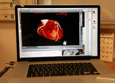 a0055913_075153.gif