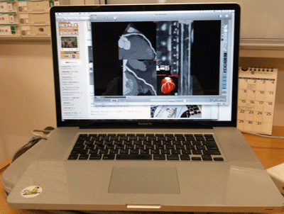 a0055913_085518.gif