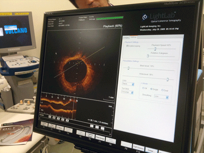 a0055913_037270.gif