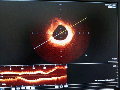 a0055913_0383537.gif