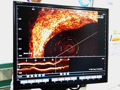 a0055913_03983.gif