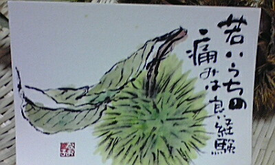 痛みの記憶_e0136066_1911093.jpg