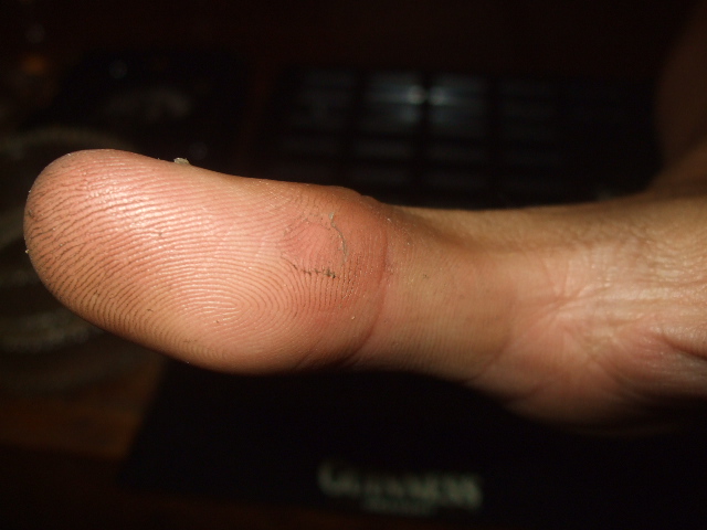 鉄人トミー 変態ツインズ_c0060469_16193458.jpg