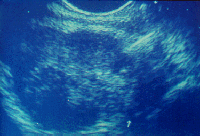 d0070361_1438263.gif