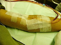 続コレステロールの薬(検査が正常でも筋損傷)_e0097212_12453145.jpg