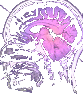 人類の生化学的な操作 by David Rothscum 5 IQの減少、そして子供の学習障害誘発_c0139575_2150333.gif