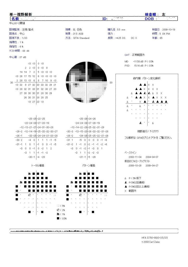 視野検査について その2 (421)_f0088231_225699.jpg