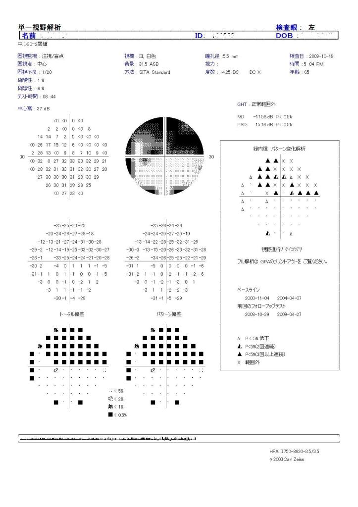 視野検査について　その２　(421)_f0088231_225699.jpg