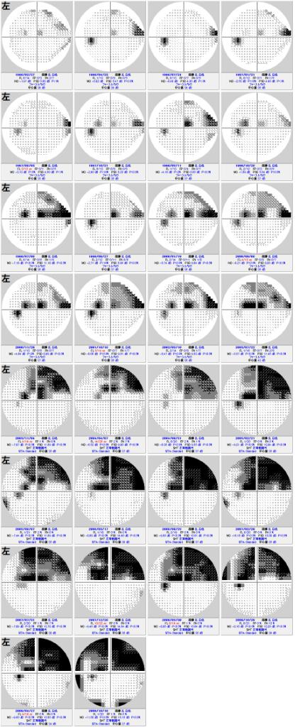 視野検査について その2 (421)_f0088231_22951.jpg