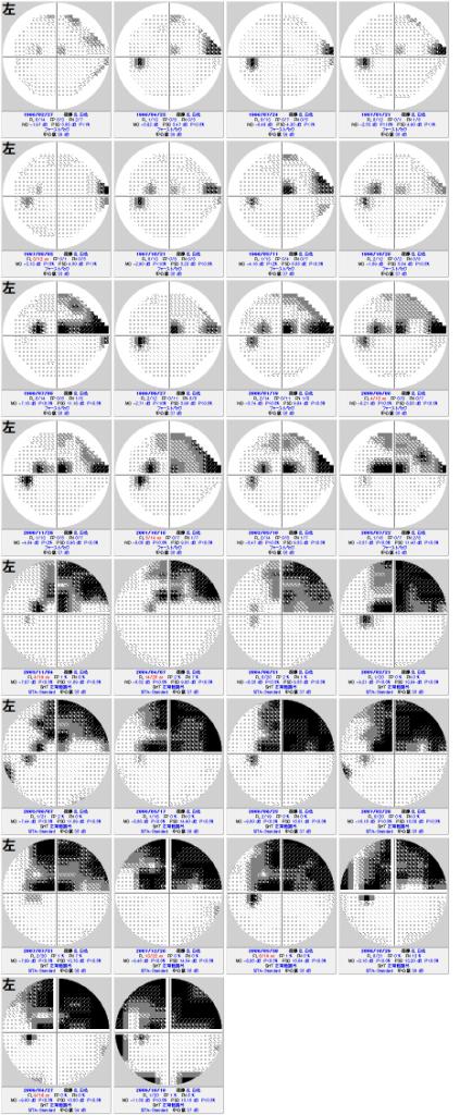 視野検査について　その２　(421)_f0088231_22951.jpg