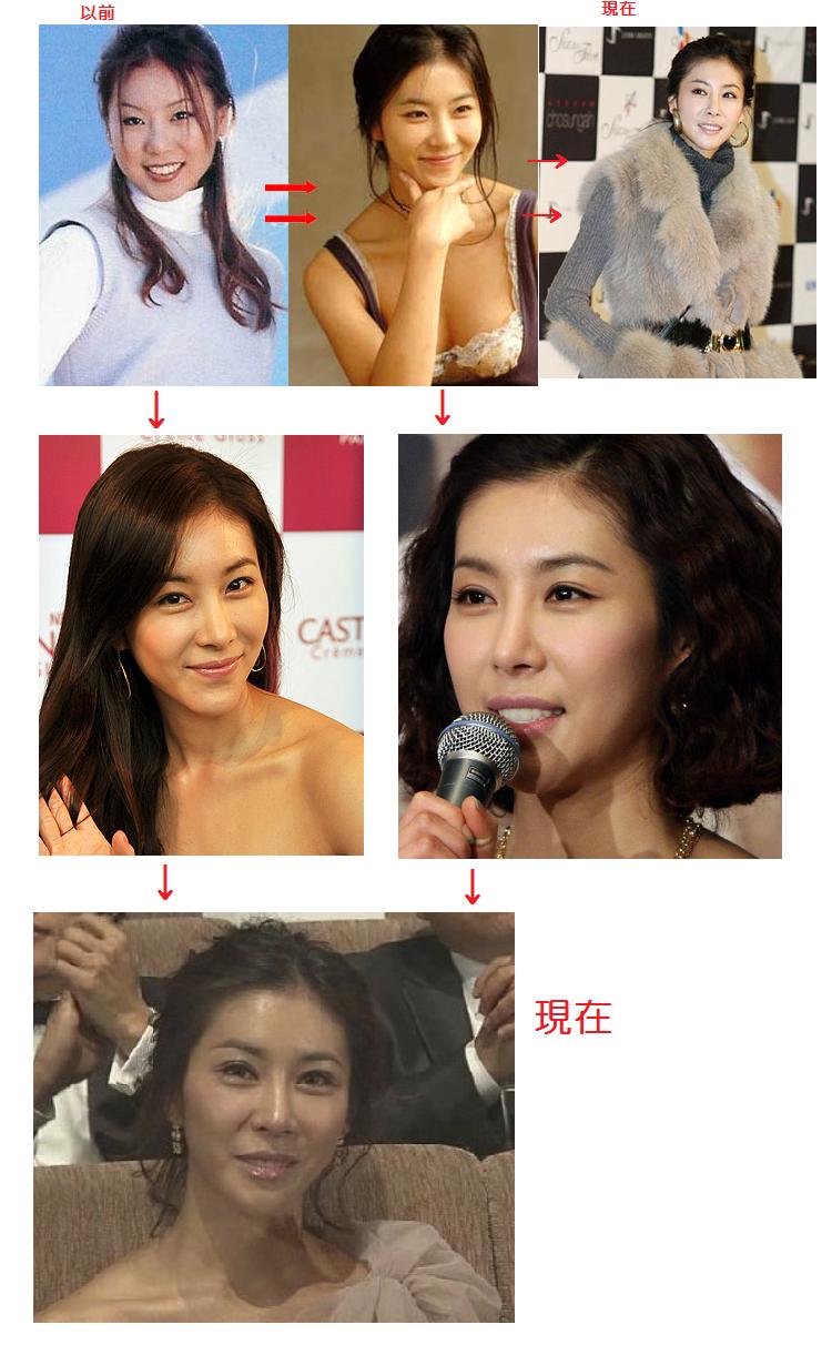 韓国芸能人の紹介 整形 top 韓国芸能人の紹介 整形 top