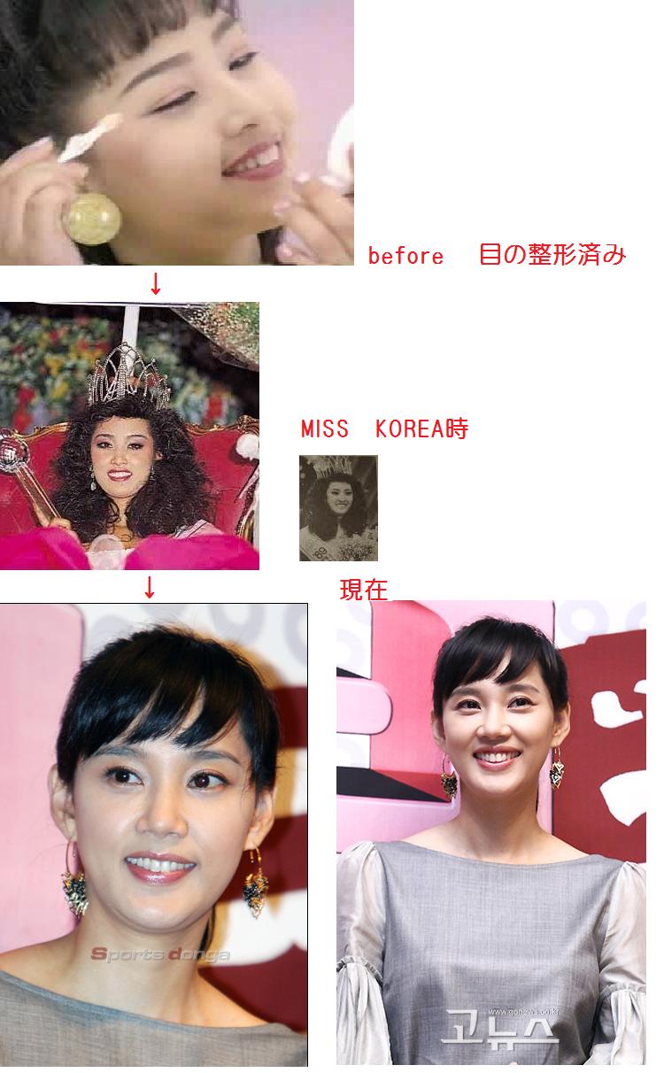 韓国芸能人の紹介 整形 top 韓国芸能人の紹介 整形 top