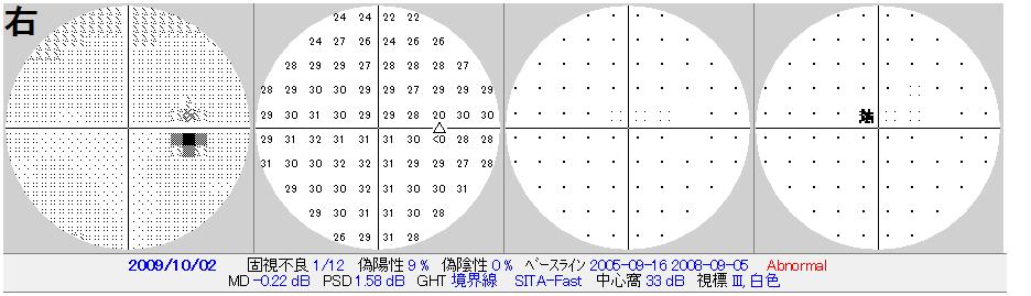 OCT画像 その2 (422)_f0088231_15551746.jpg