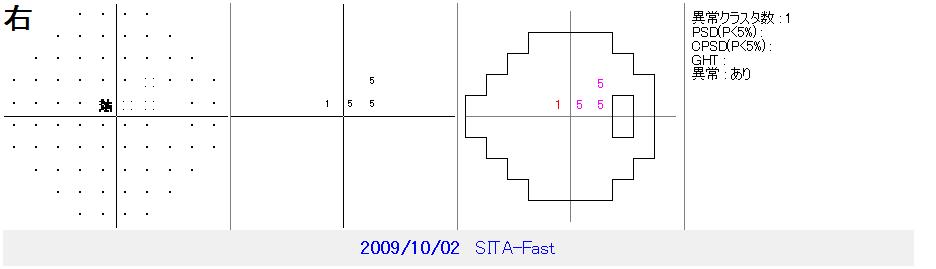 OCT画像 その2 (422)_f0088231_15554389.jpg