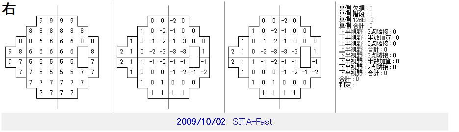 OCT画像 その2 (422)_f0088231_15563776.jpg