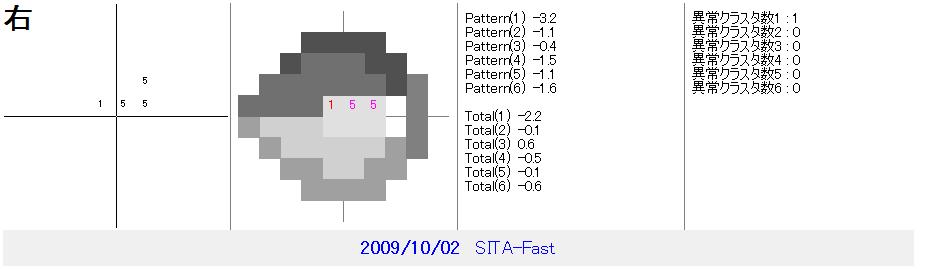 OCT画像 その2 (422)_f0088231_1558927.jpg