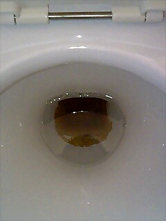 トイレの頑固な尿石クリーニング オイラの日記 富山の掃除屋さんブログ
