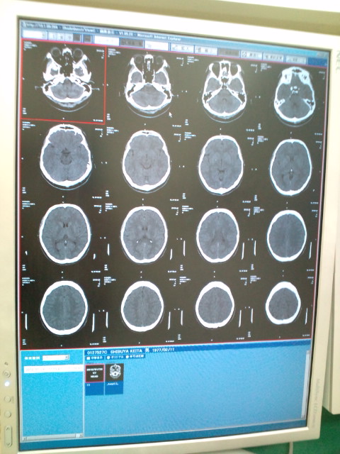 頭部を強打、大学病院で検査CT Scan。 _b0032617_12331990.jpg