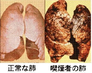 たばこでDNAまで老化 _e0097212_12552752.jpg