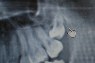 f0174854_0531187.jpg
