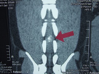 CTの活躍　その1　―椎間板ヘルニア―_b0059154_13383011.jpg