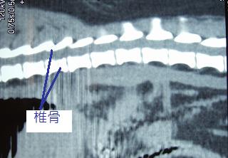 CTの活躍 その1 ―椎間板ヘルニア―_b0059154_16504757.jpg