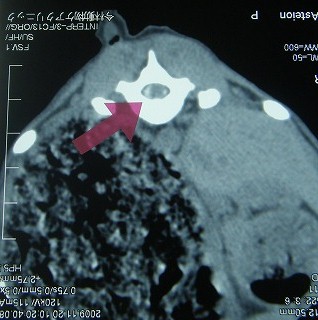 CTの活躍　その1　―椎間板ヘルニア―_b0059154_16525711.jpg