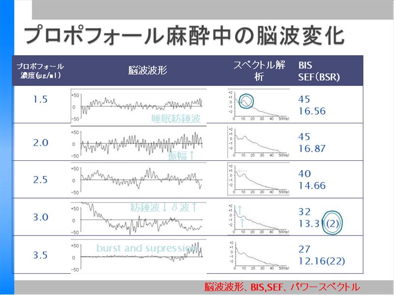  TIVA再入門その⑩_a0048974_2341680.jpg