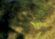 e0103408_1235511.gif