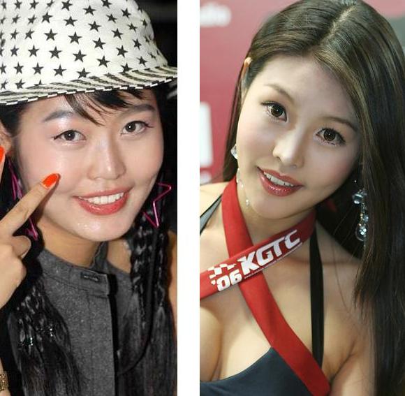 韓国の美人レースクィーン 衝撃の整形前後_f0158064_22504951.jpg