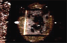 e0103408_14482675.gif