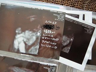 子ども写真の整理方法 エコー写真編 Ourhome 子ども写真の整理方法 エコー写真編 Ourhome