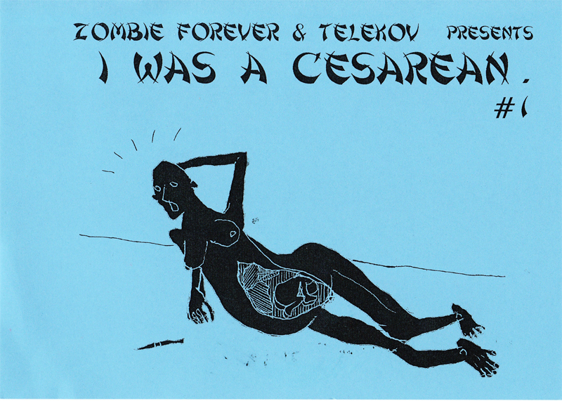 [Qurage] TELEKOV×ZOMBIE FOREVER『I WAS A CESAREAN. #1』_e0108705_00325.jpg