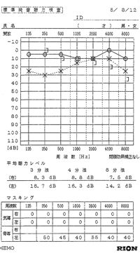自分の耳について_e0084756_10332131.jpg