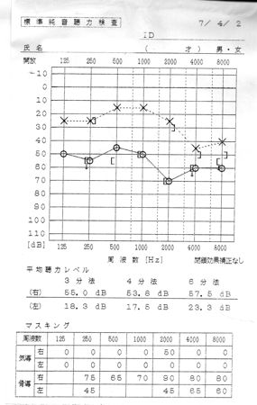 聴神経腫瘍_e0084756_2248437.jpg