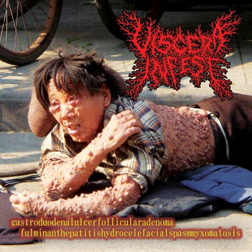 VISCERA INFEST/ PARACOCCIDIOIDOMICOSISPROCTITISSARCOMUCOSIS /Split (CD)_e0185420_14373427.jpg