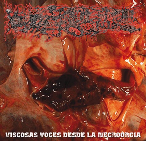 VISCERA INFEST/ PARACOCCIDIOIDOMICOSISPROCTITISSARCOMUCOSIS /Split (CD)_e0185420_14375682.jpg