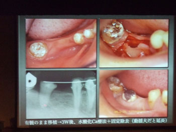 2010臨床歯科を語る会_f0154626_9325634.jpg