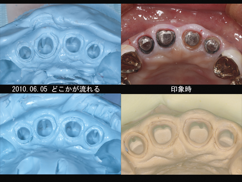 2010.06.14 救歯会例会発表_b0112648_0184261.jpg