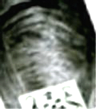 e0103408_1532525.gif