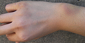 d0178580_1863788.gif