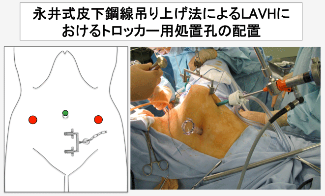 2021年製 ステップアップ内視鏡外科手術 asakusa.sub.jp